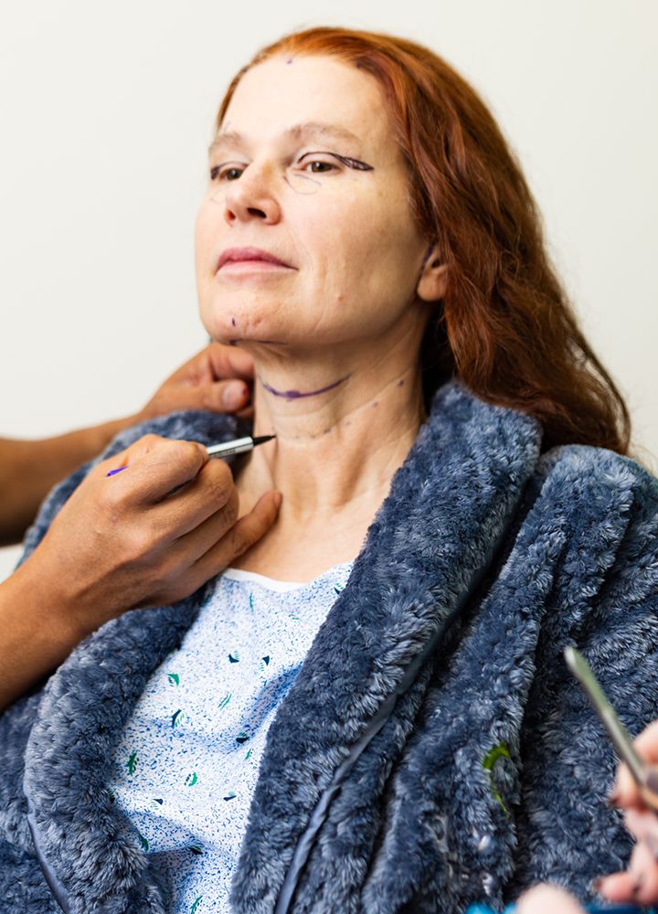 Woman receiving markings for cosmetic procedure preparation.