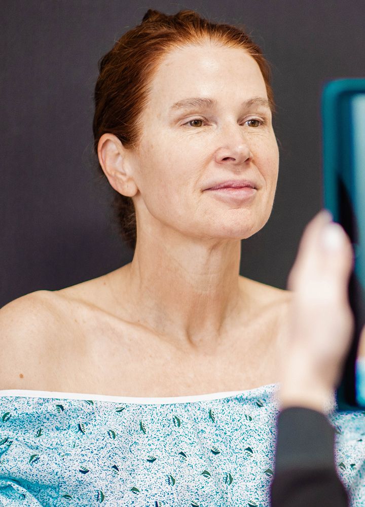 Woman posing for a beauty treatment photo.