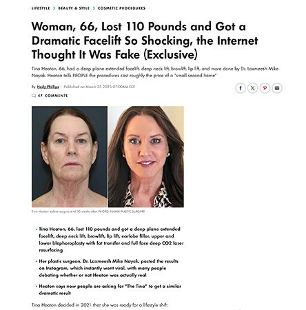 Before and after photos of woman's transformation.