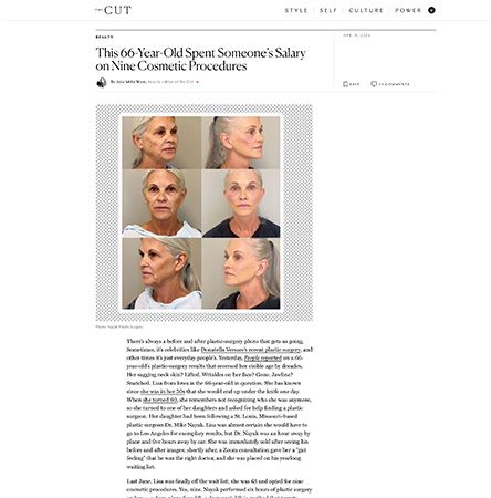 Before and after photos of cosmetic procedures.