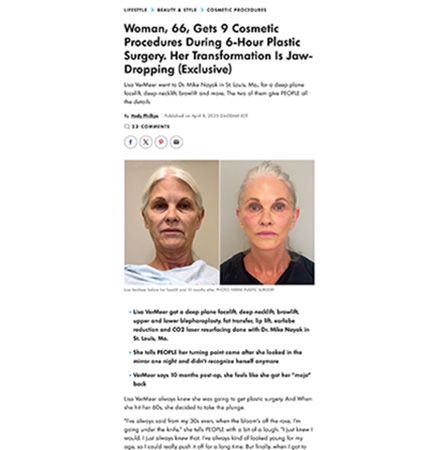 Before and after plastic surgery transformation images.