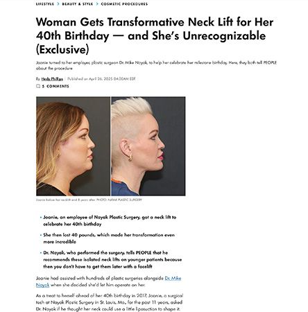 Profile comparison before and after neck lift procedure