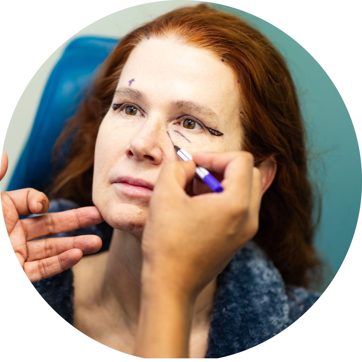 Preparing for cosmetic facial procedure with markings.